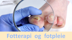 Du er her: Fotterapi og fotpleie