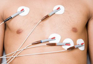 Elektroder på brystet til en mann.