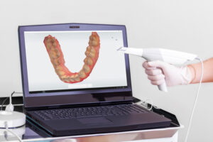 3D-bilde av tenner på en PC-skjerm.