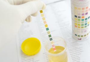 Urinprøveanalyse med strips med fargekoder.